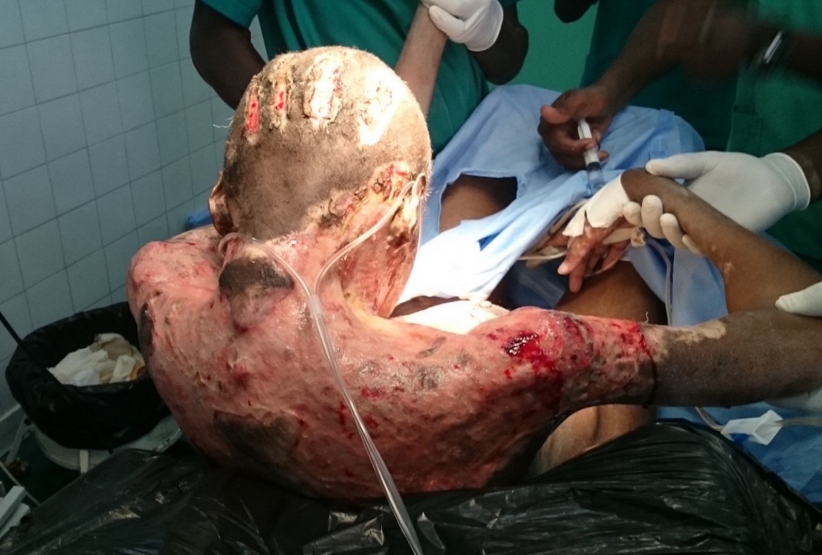 L'équipe chirurgicale au chevet de Fatima Zara dans la salle d'opération - Tchad - Mariage forcé